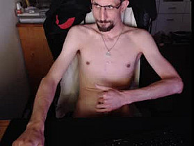 dermattes Cam